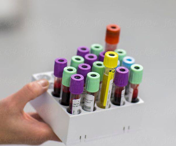 Лабораторні дослідження