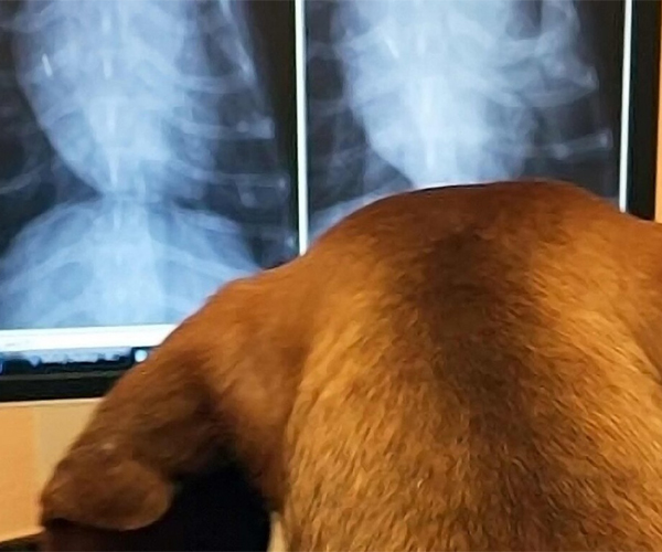 Рентгенографія